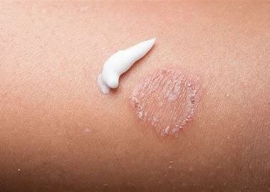 Fungal Infections: A General Review 3 OIP 11