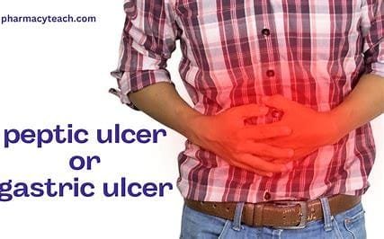 "Understanding Ulcer Disease: Causes, Risks, and Effective Treatments" 3 OIP 2024 10 19T040337.886