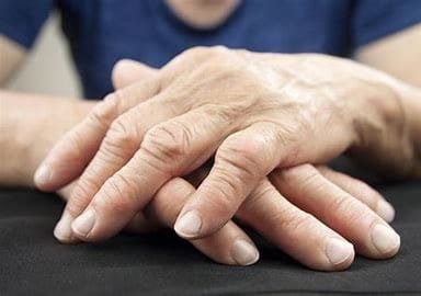 Arthritis: Understanding the Disease and Its Impact on Human Life 3 OIP 2024 10 21T071658.949