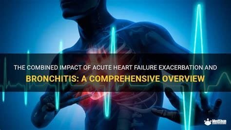 Acute Bronchitis: An Overview 3 OIP 2024 10 24T105600.505