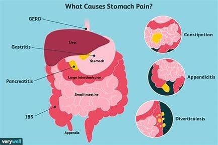 Overview of Abdominal Pain 2 OIP 42