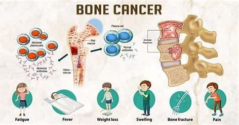 Muscle and Bone Cancer: Impact on Human Health and Medical Treatment 3 download 2024 10 27T082459.513