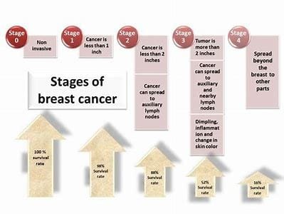 Breast Cancer: Causes, Symptoms, Treatment, and Life Impact 4 download 2024 10 29T211604.212