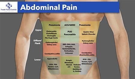 Overview of Abdominal Pain 3 download 21