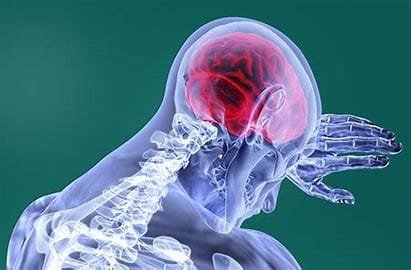 Paralysis: How it is Affecting Human Life? 4 download 72