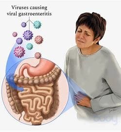 Overview of Abdominal Pain 4 th 26