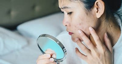 "Skin Diseases: Types, Causes, Symptoms, and Treatments" 4 th 72