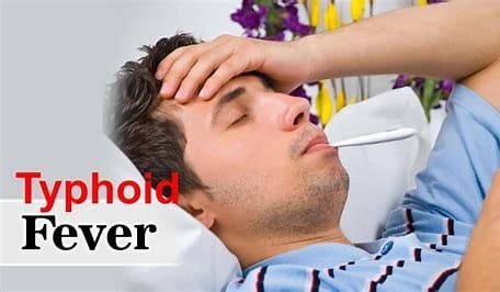 "Typhoid Fever: Causes, Symptoms, Treatment, and Prevention" 2 OIP 2024 11 11T211414.903