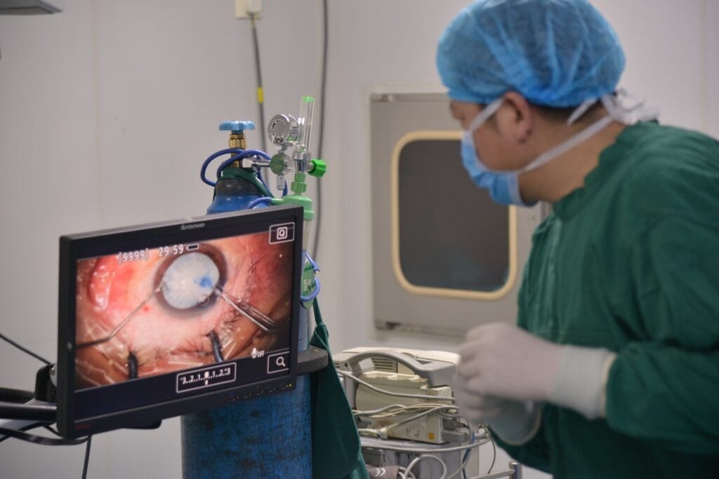 "Deviated Septum Surgery: 9 Life-Changing Benefits for Easier Breathing" 4 cataract rupture 7455449 1280