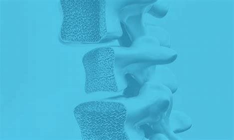 "Osteoporosis: Causes, Symptoms, and Best Treatments" 4 download 2024 11 01T043308.284