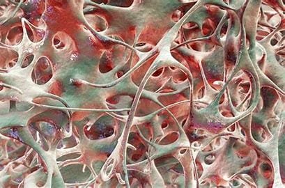 "Osteoporosis: Causes, Symptoms, and Best Treatments" 2 download 2024 11 01T043346.973