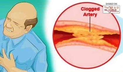 "How to Keep Your Arteries Clear and Reduce Heart Disease Risk" 2 download 2024 11 01T072116.488