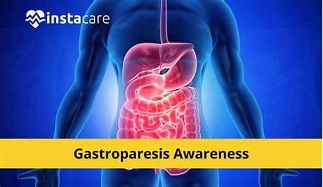 Gastroparesis: Knowing Causes, Symptoms, and Treatment 3 download 2024 11 02T211938.978