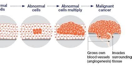 What is cancer, and how does it develop in the human body? 3 download 2024 11 04T211916.211