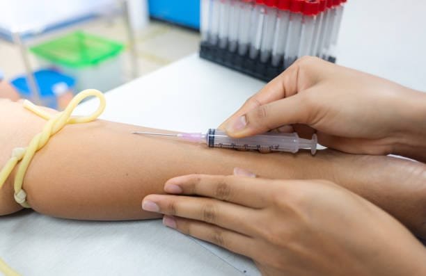Anemia: What It's, Symptoms of Cause, Risk Factors, and Treatments 3 istockphoto 1136265792 612x612 1