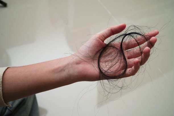 How Not to Lose Your Hair: The Biological Science Perspective 4 istockphoto 1472694949 612x612 1