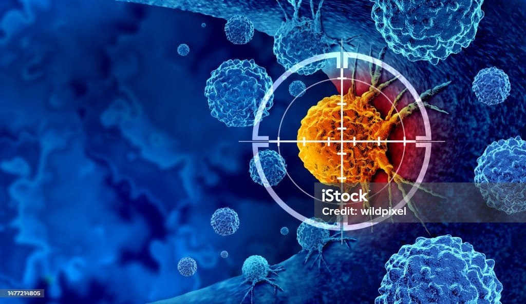 "A Complete Guide to Ovarian Cancer: Symptoms, Stages, and Treatment" 4 istockphoto 1477214805 1024x1024 3