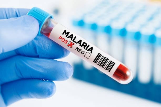 "Plasmodium Diseases: Impact, Diagnosis, and Treatment" 4 istockphoto 2165522662 612x612 1
