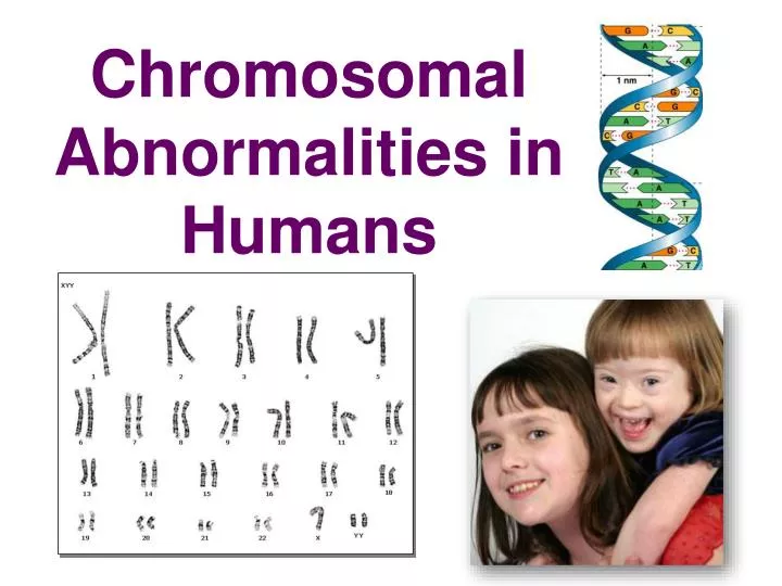 Chromosomal Disorders: 5 Life-Changing Facts You Must Know 3 slide1 n 1
