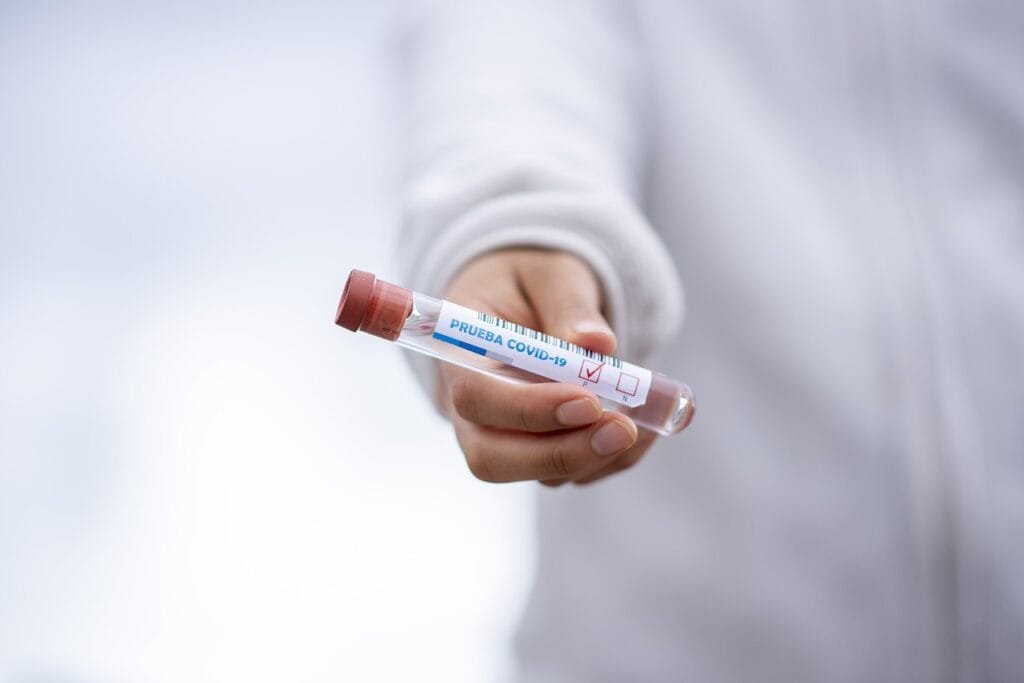 Coronavirus: Causes, Symptoms, Risks, and Treatments 3 test tube 5065426 1280